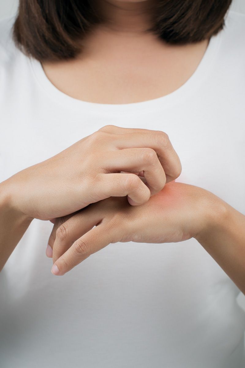 2. Atopic Dermatitis.jpg